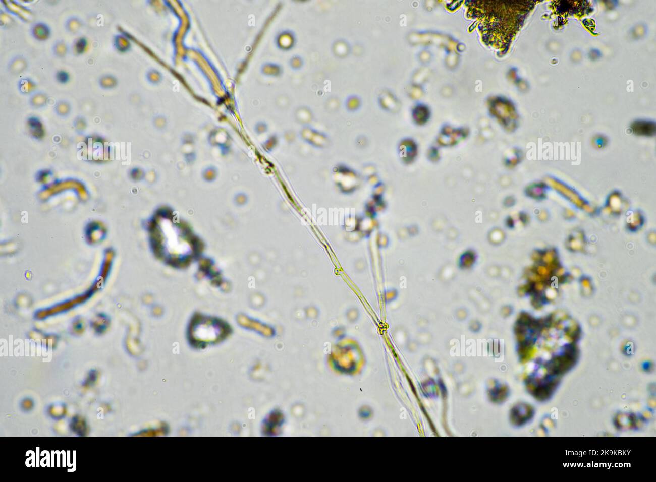 soil sample under the microscope. soil fungi and cycling