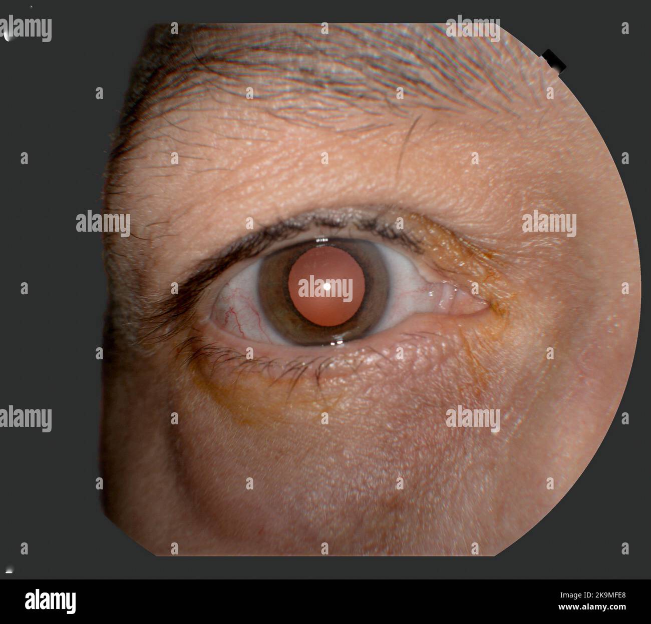 Photography of Human Eye Retina Stock Photo