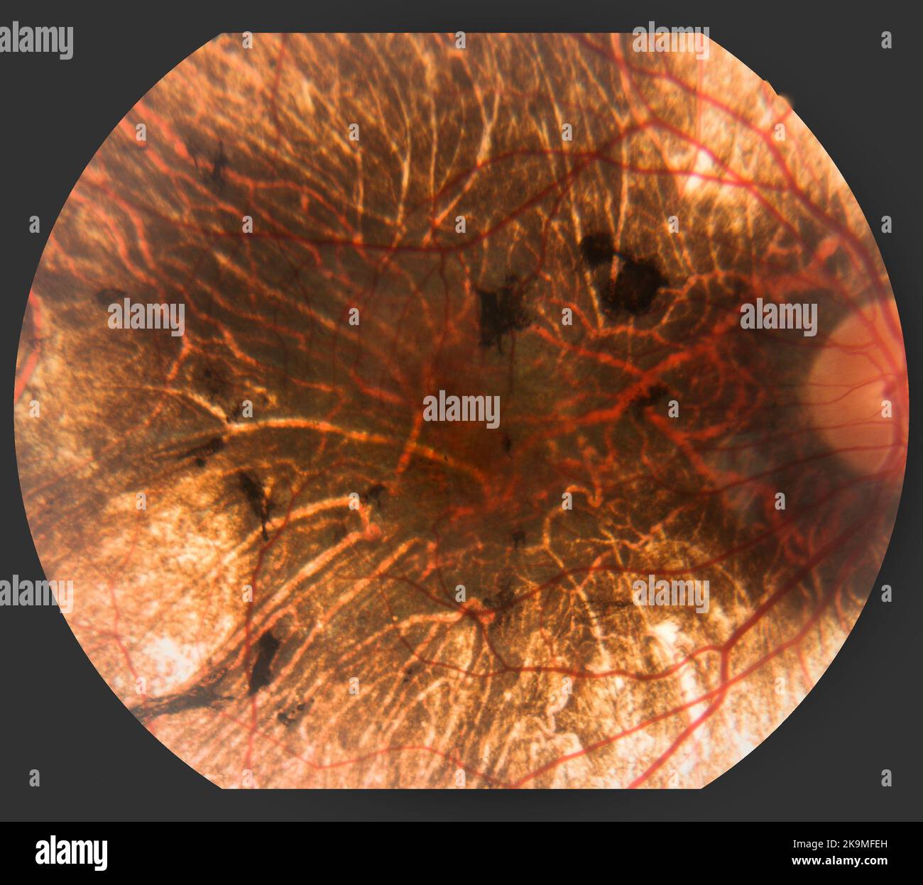 Photography of Human Eye Retina Stock Photo