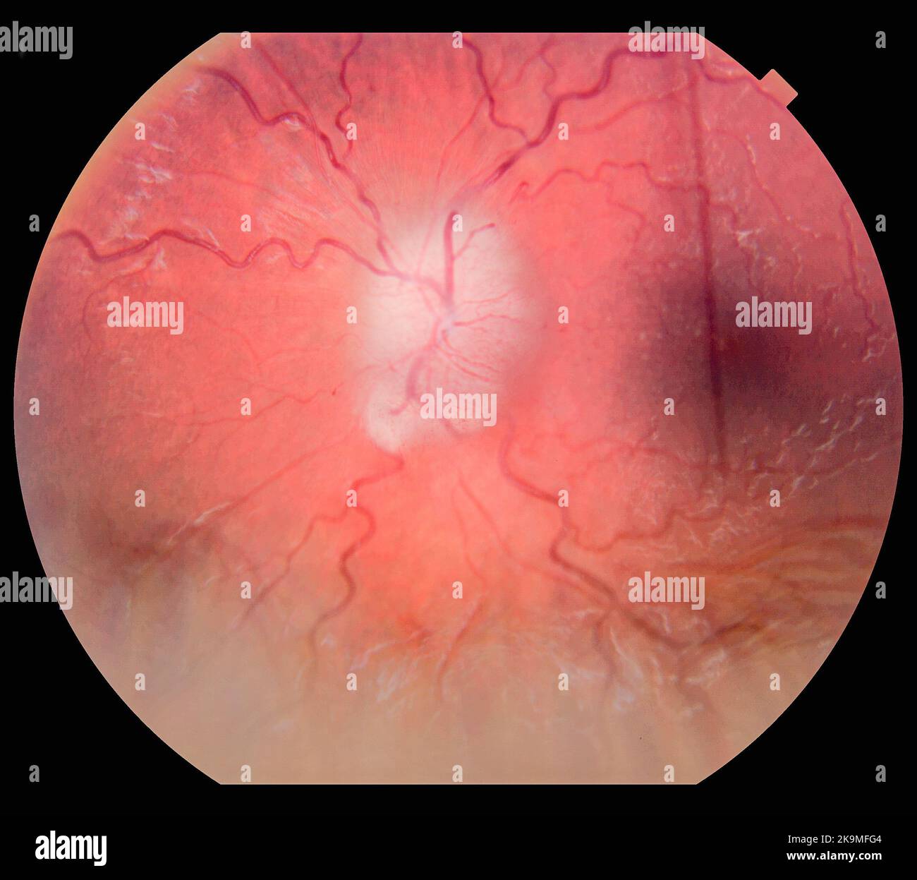 Photography of Human Eye Retina Stock Photo
