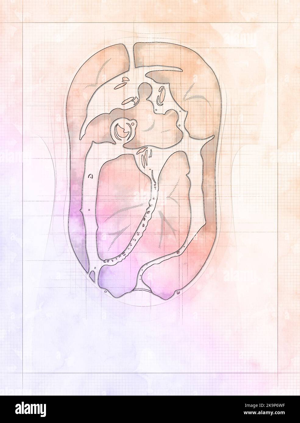 Peritoneal Dialysis is a replacement treatment for end-stage chronic renal failure alternative to hemodialysis. Thoracic section of a human body Stock Photo