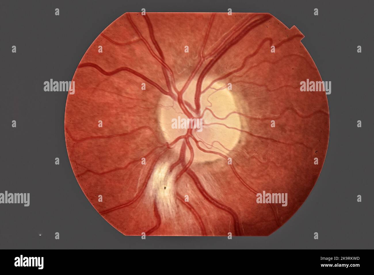 Photo of human eye anatomy Stock Photo