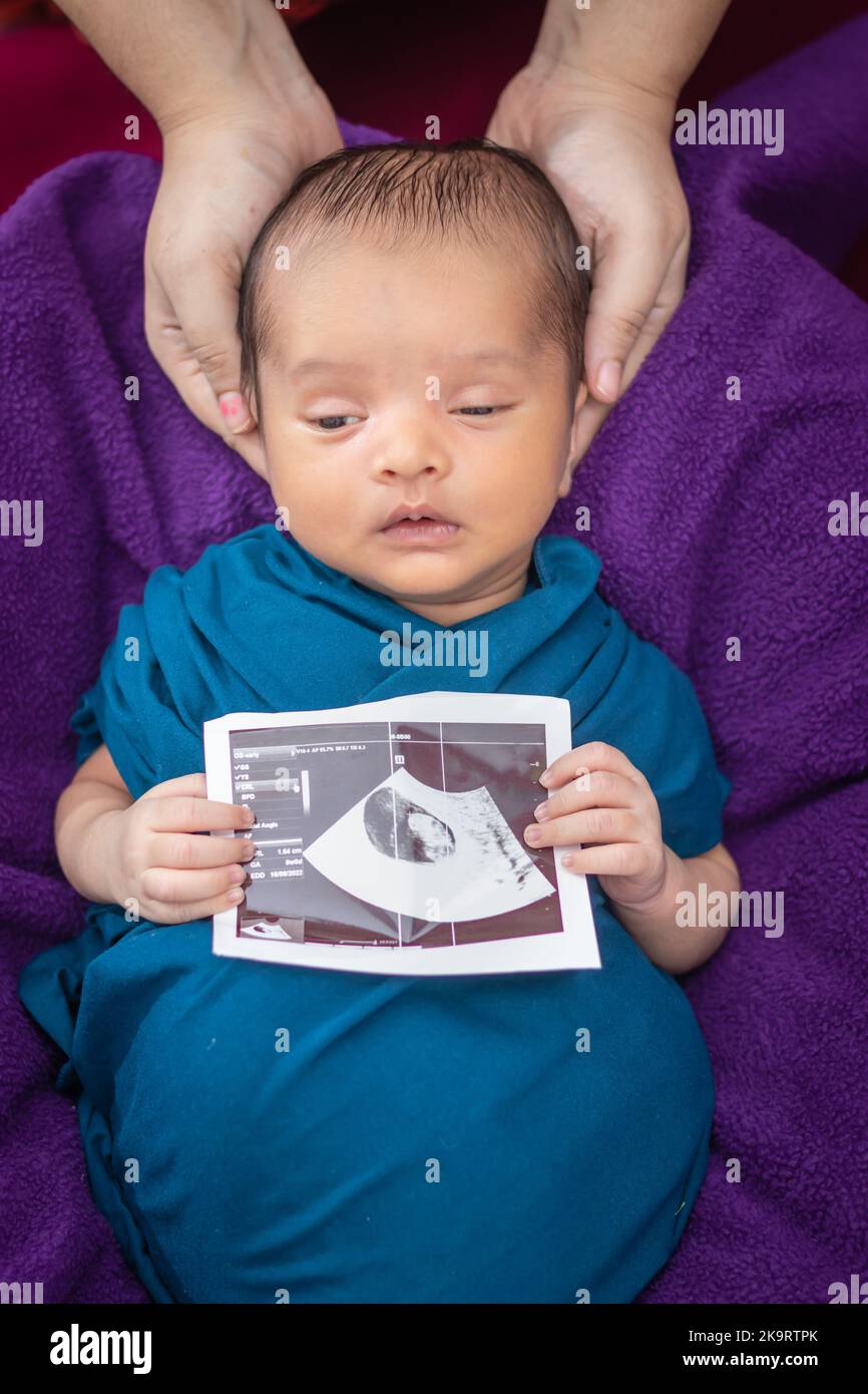 newborn baby holding ultrasound copy in hand and sleeping at mother palm in baby wrap Stock Photo