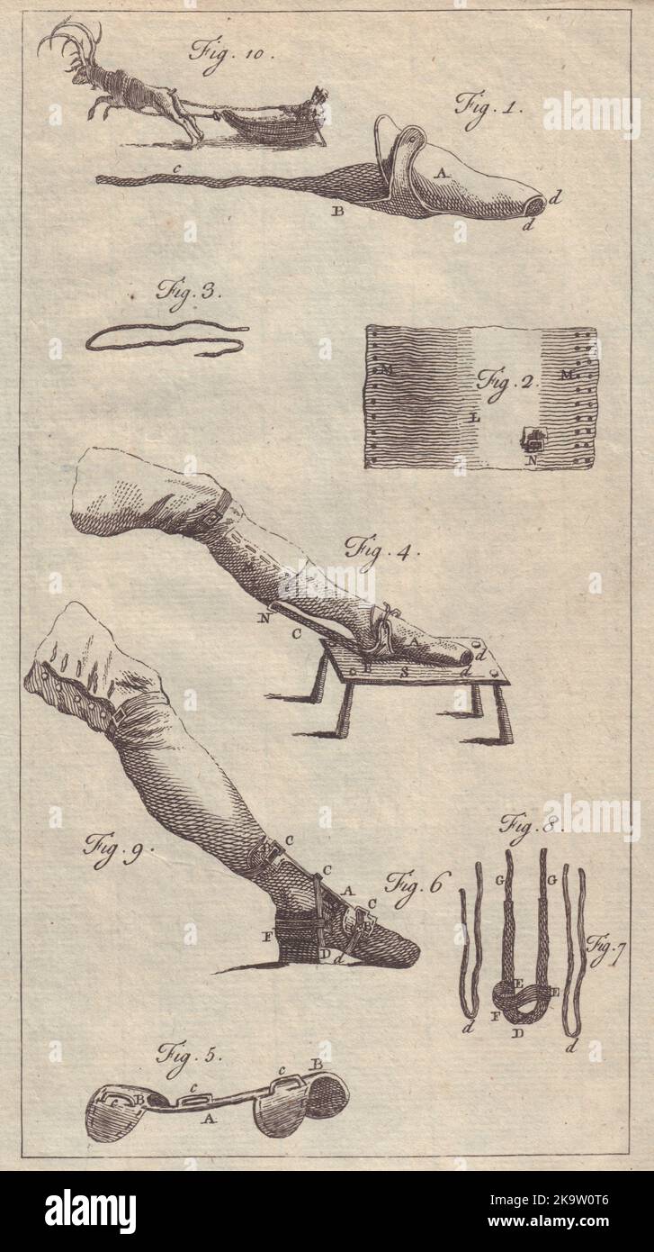 Surgical bandages for achilles tendon rupture. Laplander Pulka Reindeer 1754 Stock Photo