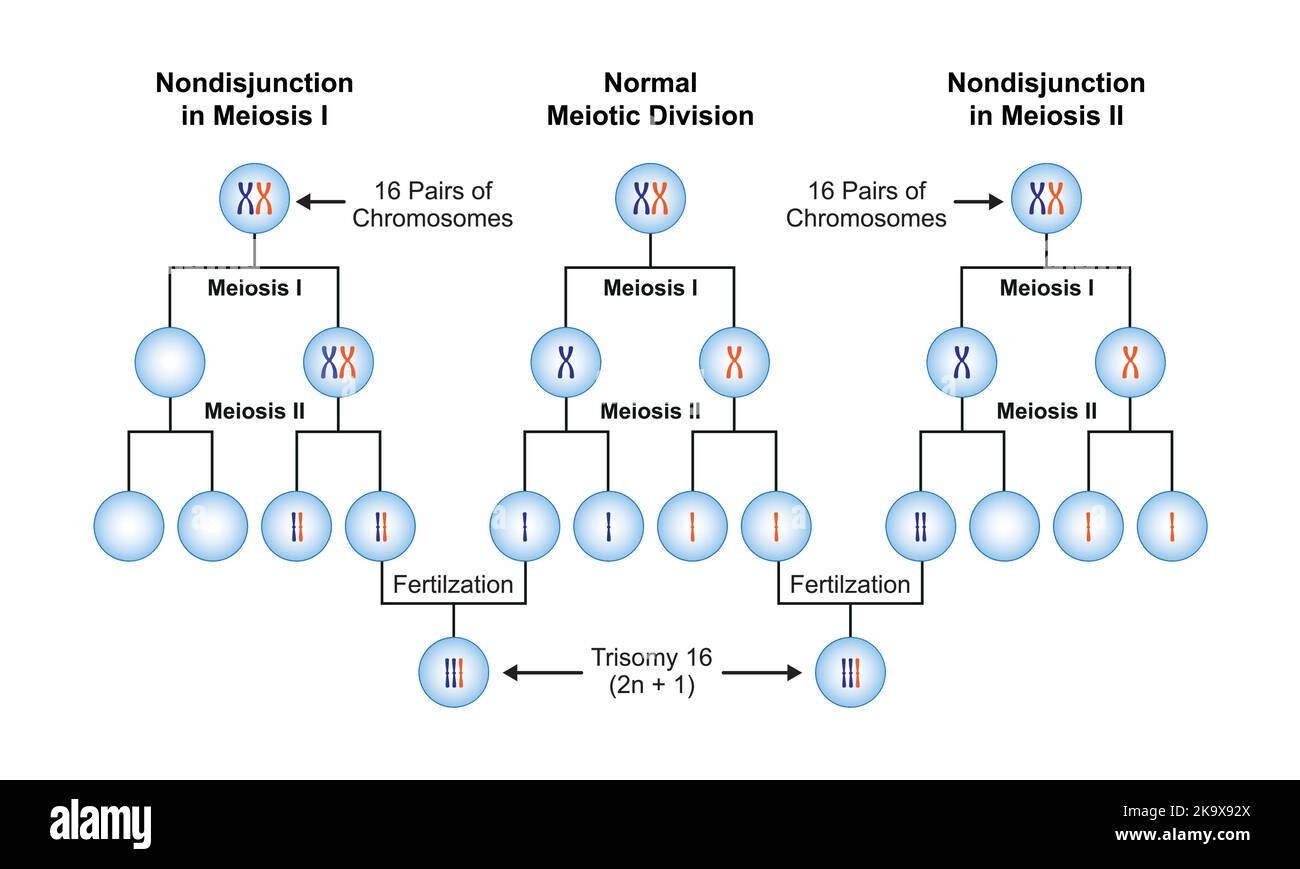 Scientific Designing of Nondisjunction in Trisomy 16. Colorful Symbols. Vector Illustration. Stock Vector