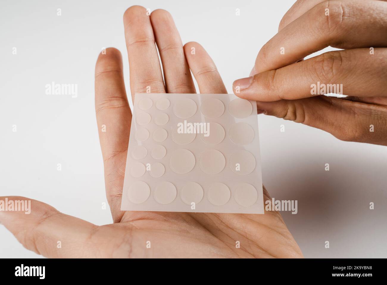 The 17 Best Acne Treatments, According to Dermatologists