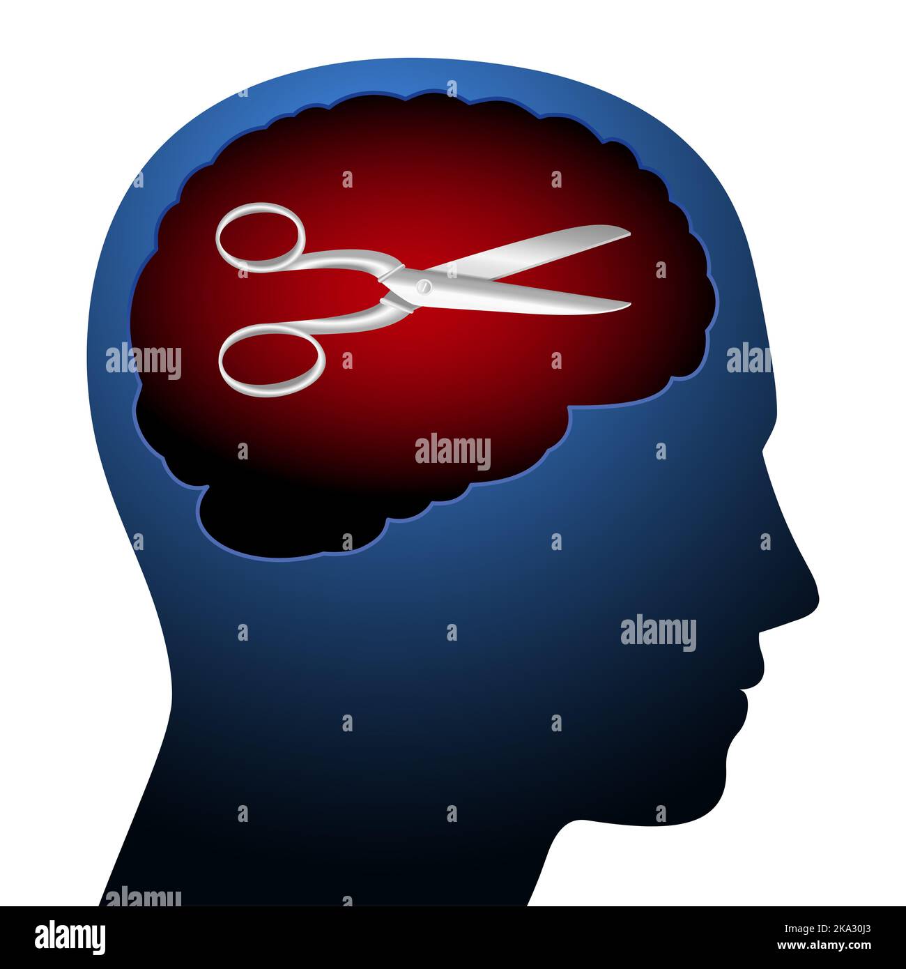 The scissors in the head, symbol for self-censorship. Metaphor used in German speaking area for the act of censoring or classifying the own discourse. Stock Photo