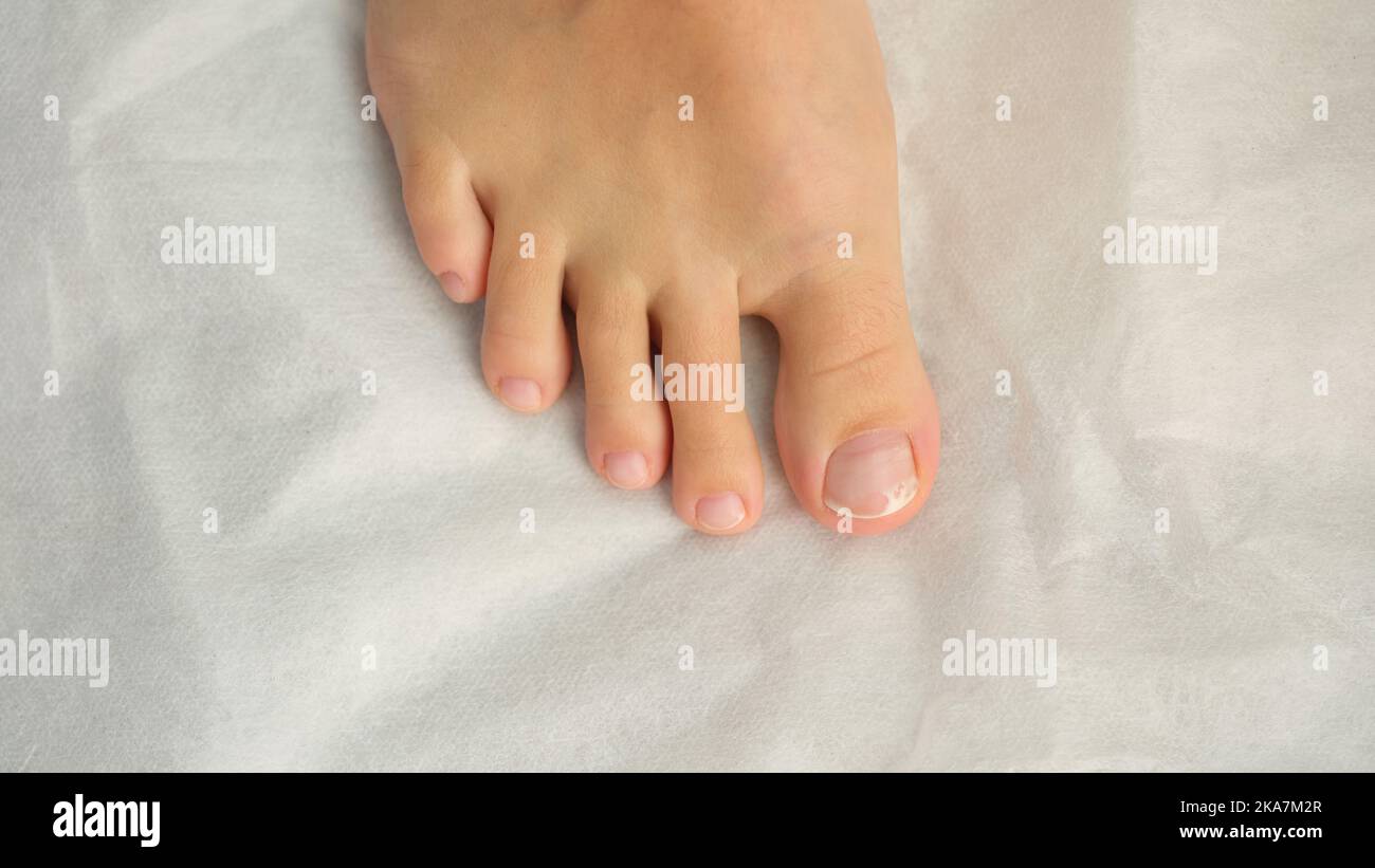 Female foot with pedicure, cosmetic treatment of feet and toenails Stock Photo