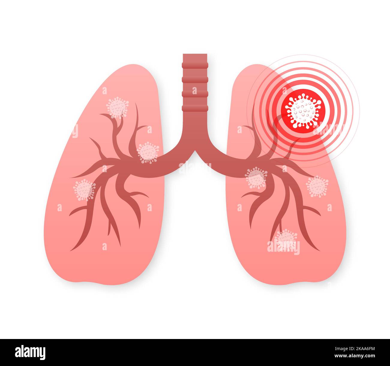 Lungs pain. Vector illustration icon. Isolated vector illustration.Medical icon. Stock Vector