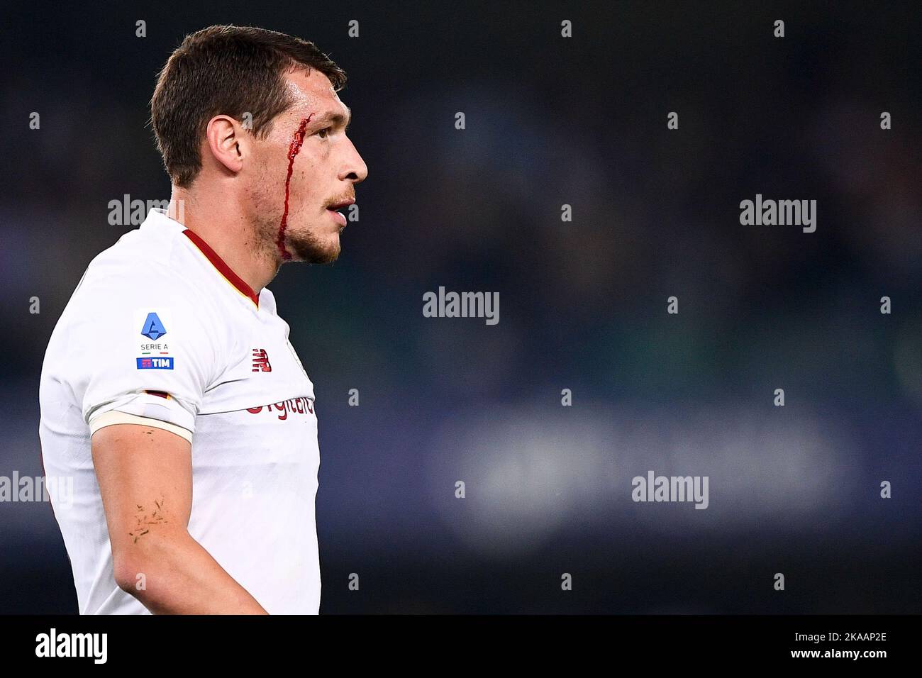 Verona, Italy. 31 October 2022. Andrea Belotti of AS Roma bleeds during the Serie A football match between Hellas Verona FC and AS Roma. Credit: Nicolò Campo/Alamy Live News Stock Photo