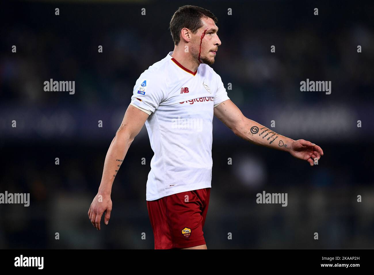 Verona, Italy. 31 October 2022. Andrea Belotti of AS Roma bleeds during the Serie A football match between Hellas Verona FC and AS Roma. Credit: Nicolò Campo/Alamy Live News Stock Photo
