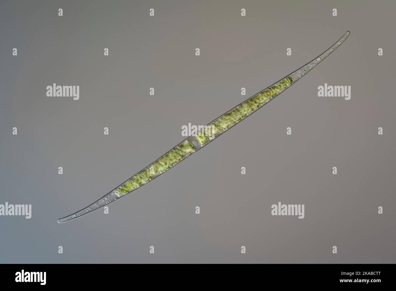 Green alga, light micrograph Stock Photo Alamy