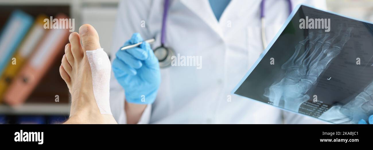 Doctor checks xray of legs of patient with injury Stock Photo Alamy