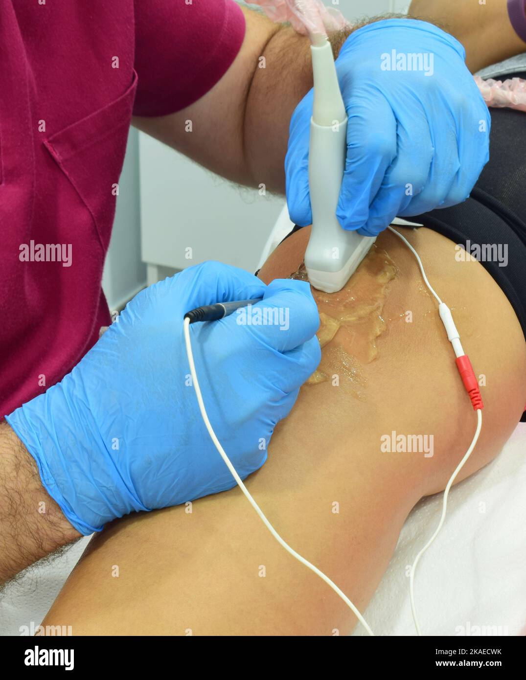 Healthcare electrolysis hi-res stock photography and images - Alamy