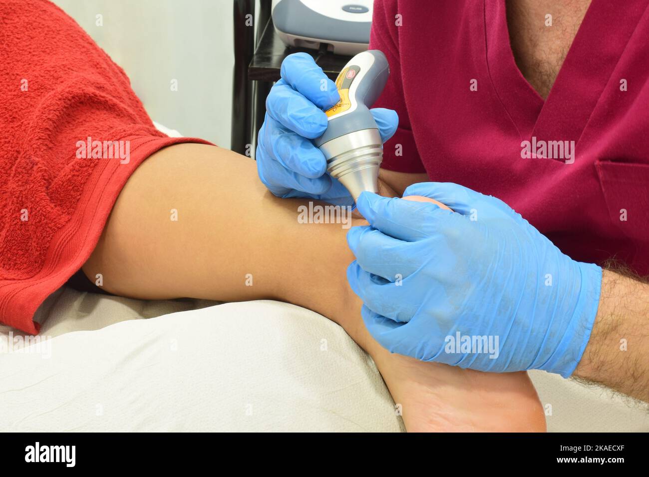 Percutaneous electrolysis hi-res stock photography and images - Alamy