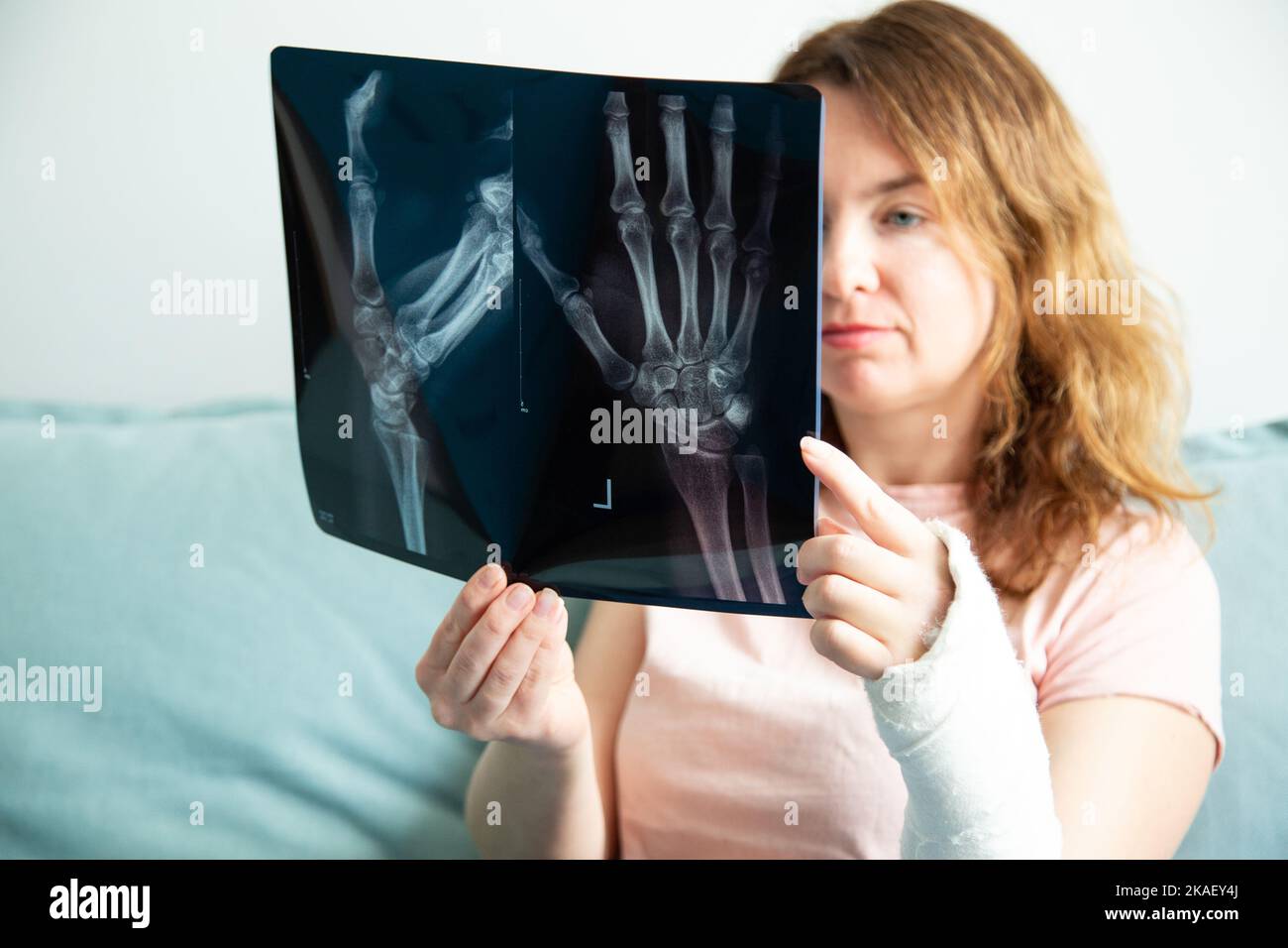 A female patient is looking at her X-ray with a broken arm in a plaster cast. Stock Photo