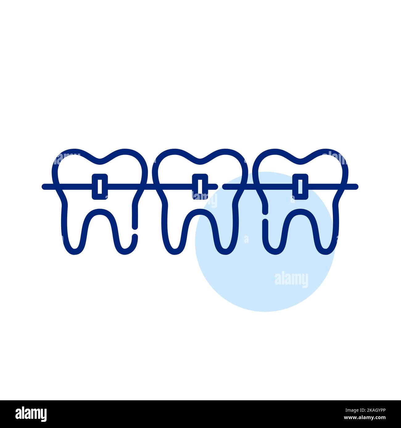 Teeth with braces. Orthodontist treatment. Pixel perfect, editable