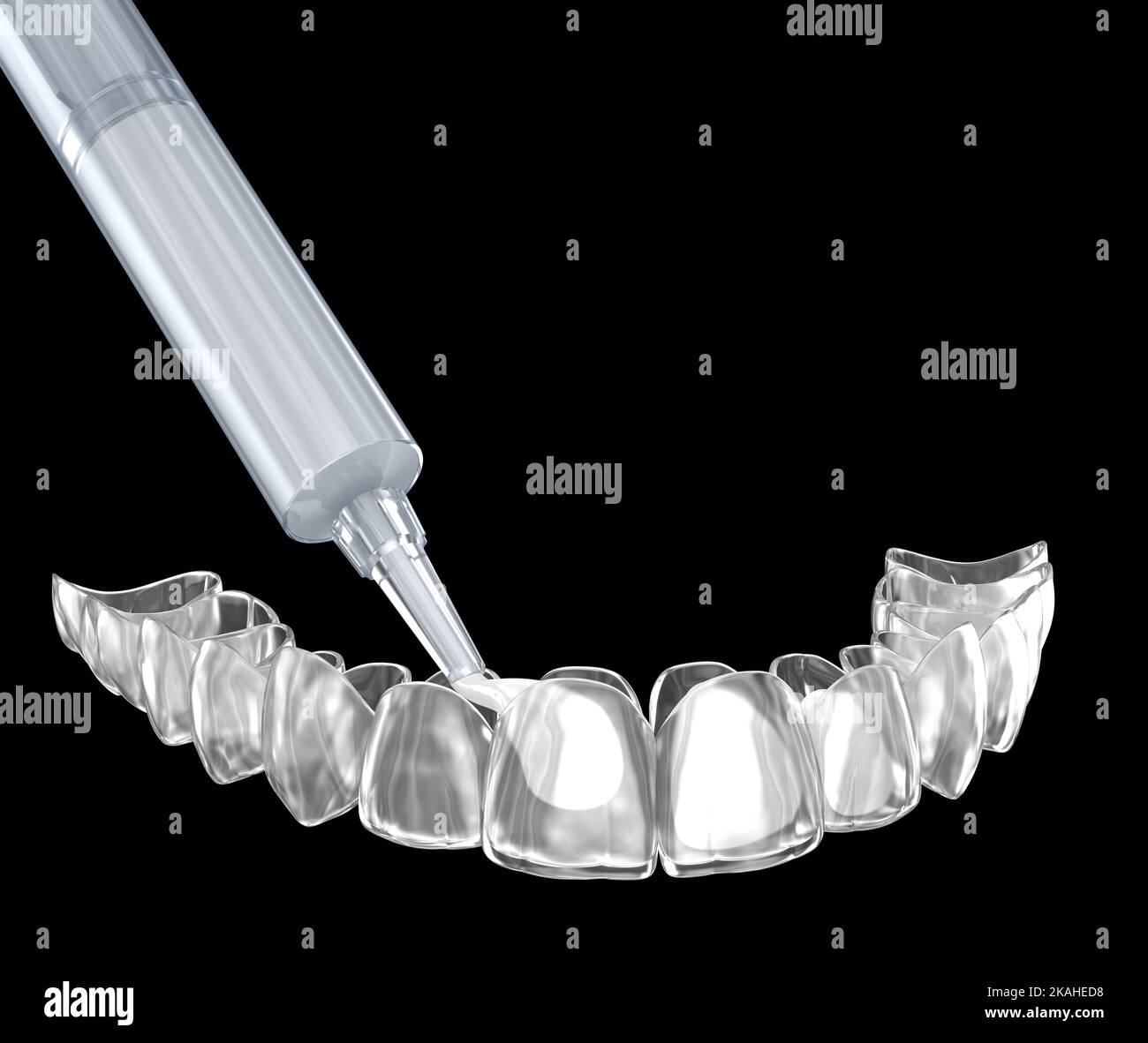 Teeth whitening kit, adding gel in to invisalign. 3D illustration