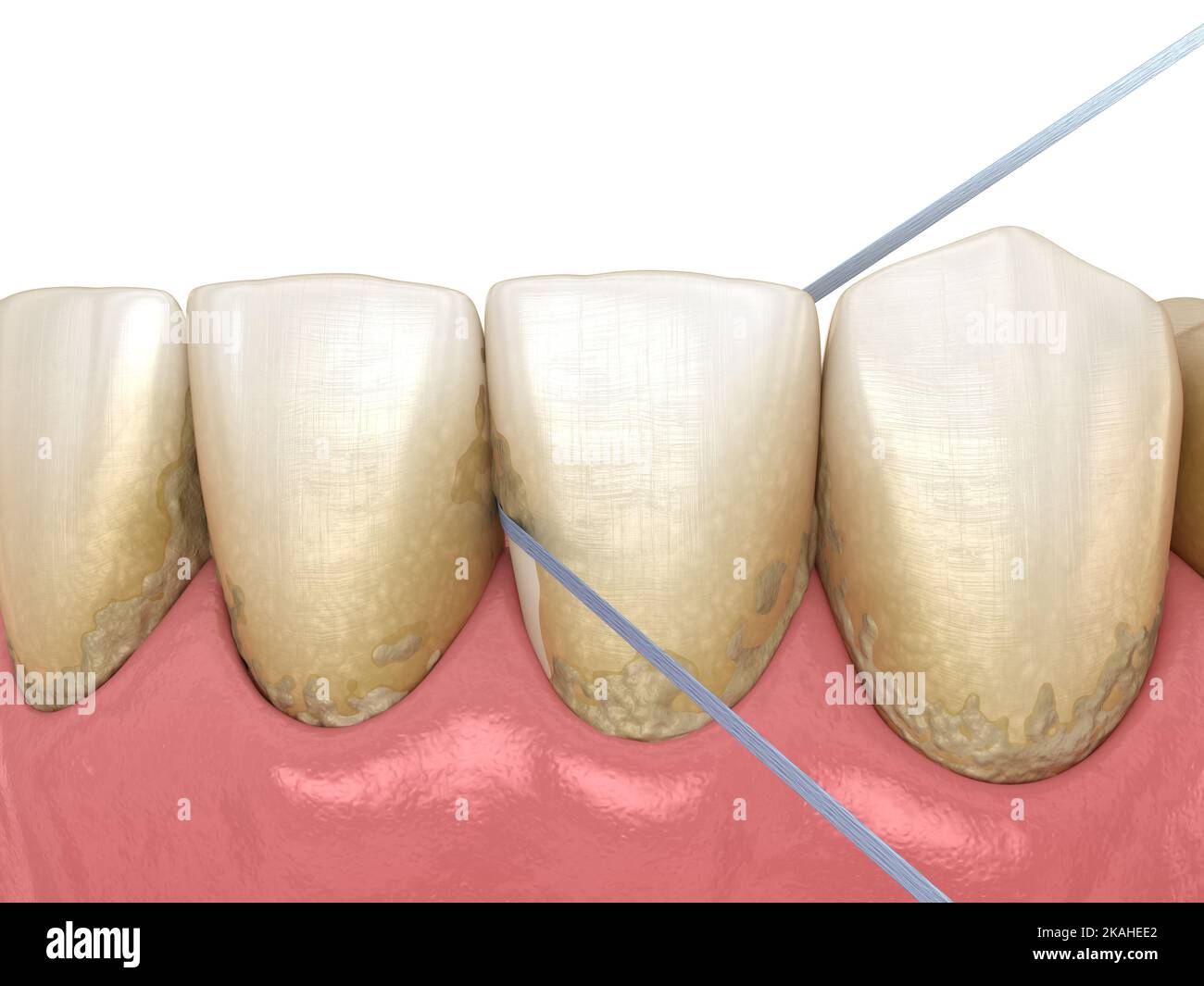 Dental floss cleaning process. Medically accurate dental 3D