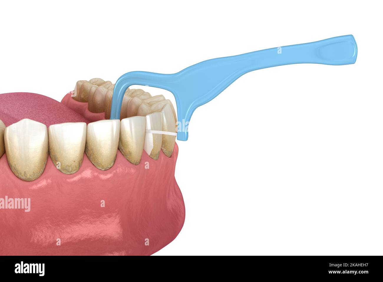 Oral hygiene using toothpick dental floss to remove food stuck from