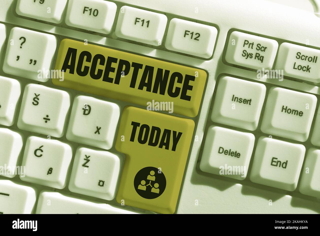 Text sign showing Acceptance. Internet Concept a condition or a person producing or showing no symptoms Man With Tablet Pointing On A Globe Image Stock Photo