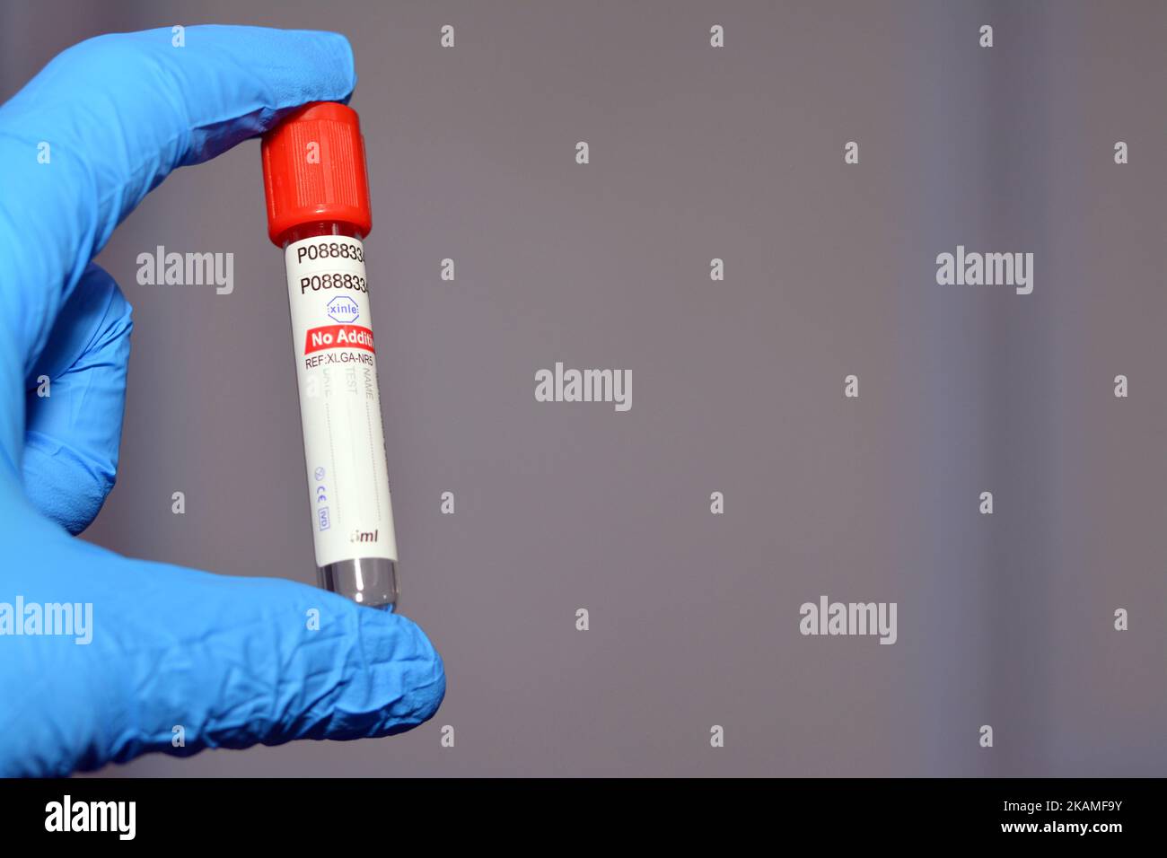 Cairo, Egypt, October 22 2022: Blood collection tube for collecting blood samples for laboratory analysis tests like CBC complete blood count, ESR, CR Stock Photo