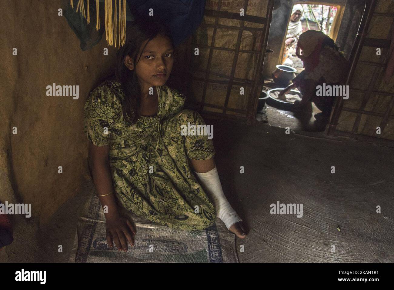 A homeless Rohingya girl with a bullet injury in her left leg is taking ...