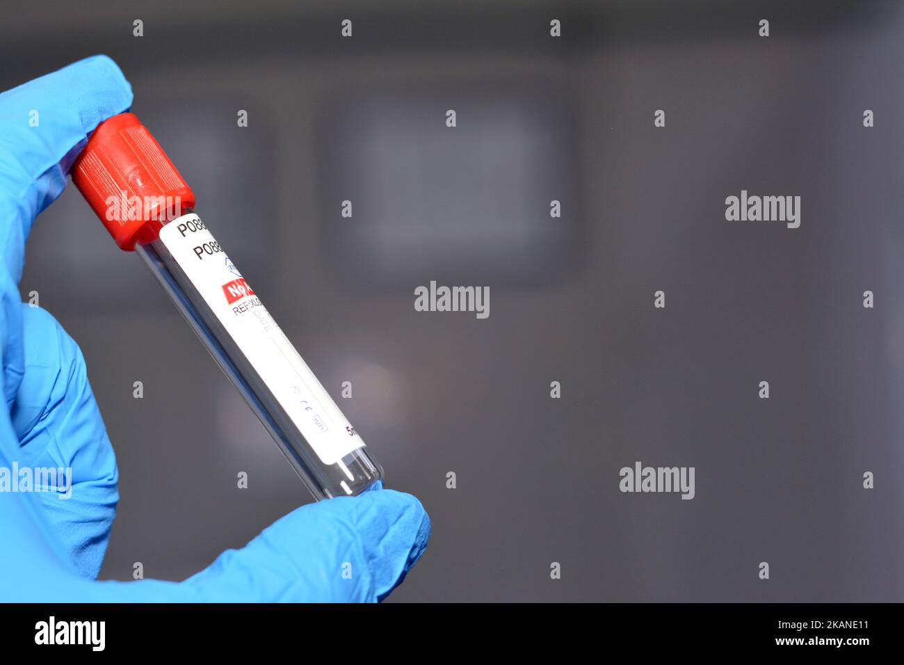 Cairo, Egypt, October 22 2022 Blood collection tube for collecting