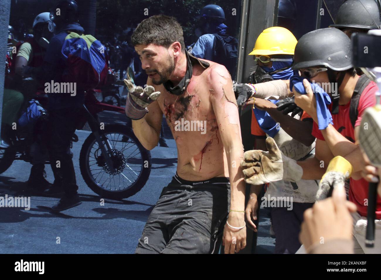 An injured anti-government demonstrator is carried away as security forces block a march from reaching the office of Attorney General Luisa Ortega Diaz to show support for the one-time government loyalist, in Caracas, Venezuela, Thursday, June 22, 2017. Venezuela's Supreme Court cleared the way for the prosecution of the country's chief prosecutor, who became a surprise hero to the opposition after breaking ranks with the government of President Nicolas Maduro over his efforts to concentrate power. (Photo by Elyxandro Cegarra/NurPhoto) *** Please Use Credit from Credit Field *** Stock Photo