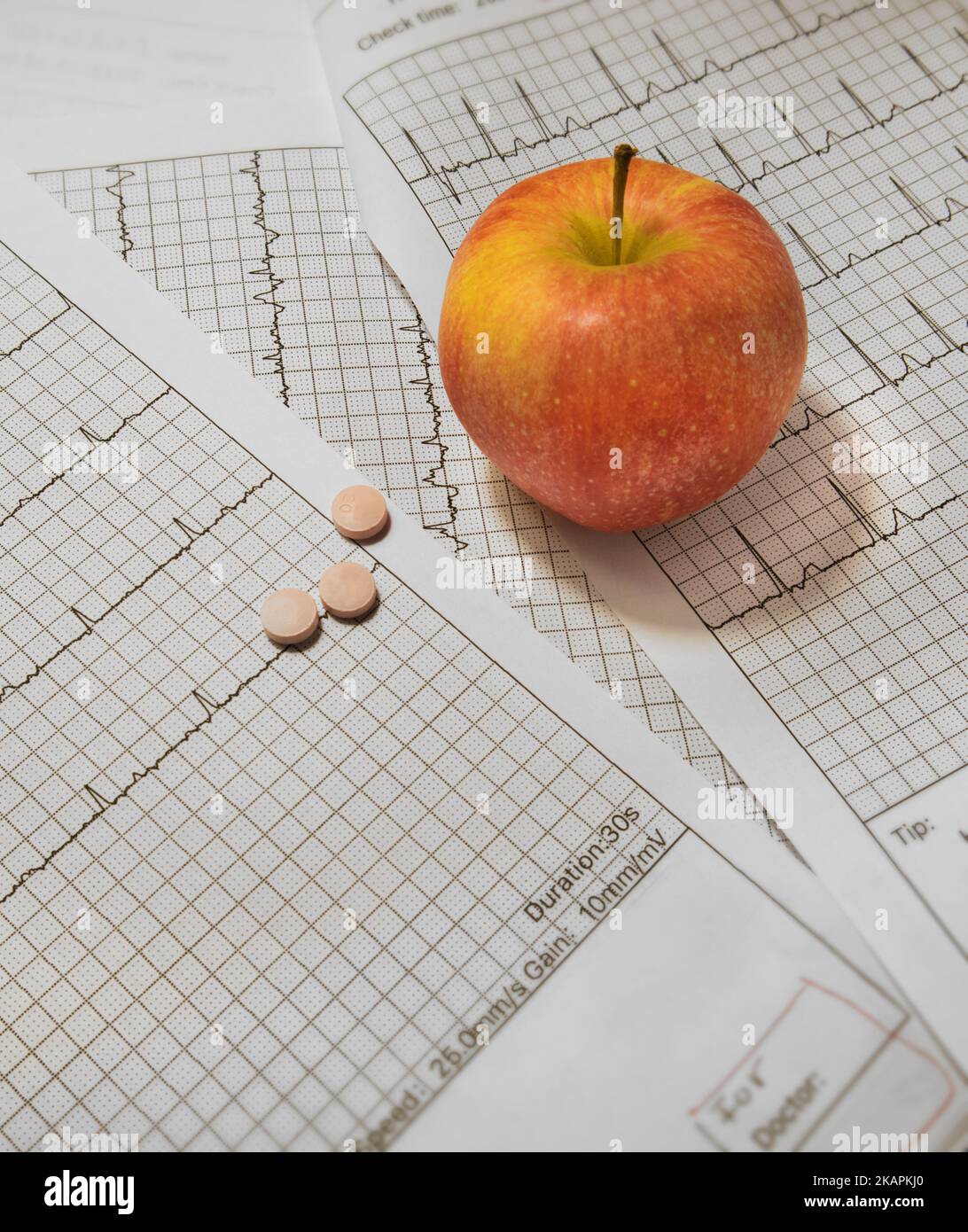 ECG- EKGs, pills, an apple. Stock Photo