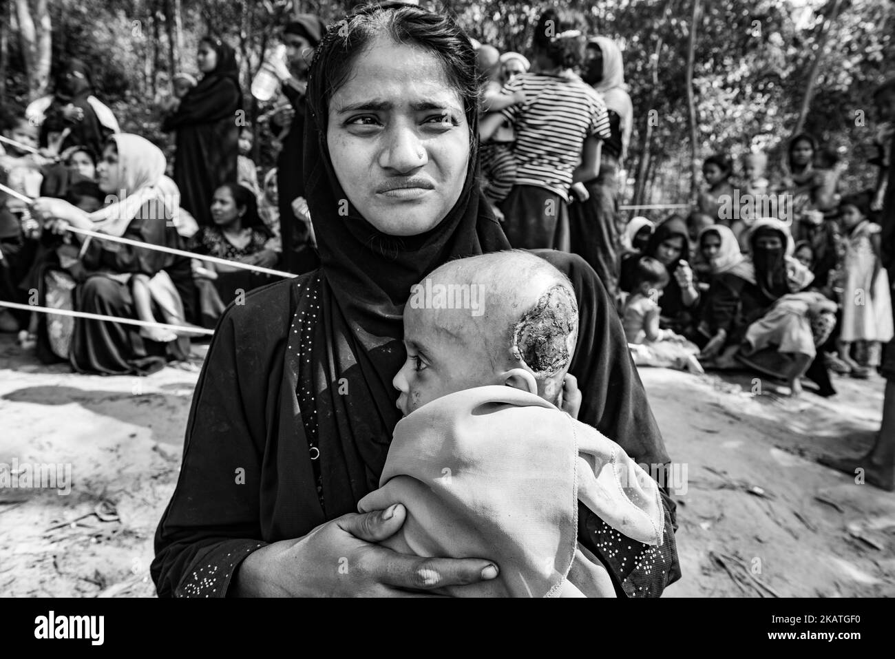 Rohingya refugee, 22-year-old Asmida Akter holds her three months old baby with skull infaction waiting for medical help in a field clinic by the non-governmental organization Mercy Malaysia in the Thankhali refugee camp near Cox's Bazaar, Bangladesh, November 22, 2017. (Photo by Szymon Barylski/NurPhoto) Stock Photo