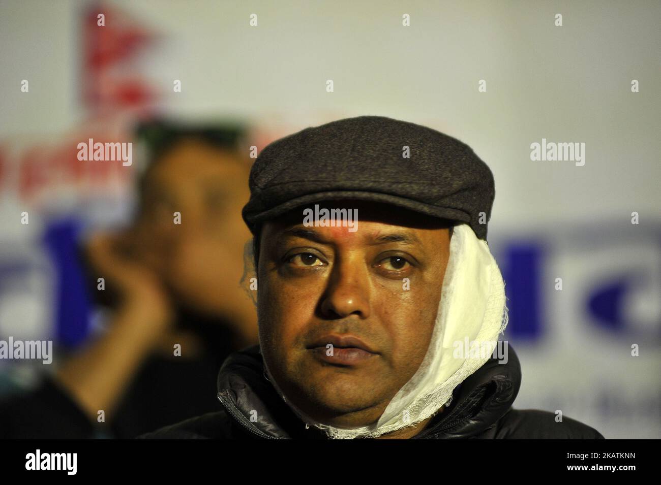 A Portrait of injured Nepali Congress candidate Gagan Thapa attends mass meeting venue for election campaign at Kathmandu, Nepal on Monday, December 04, 2017. Gagan Thapa and 10 others were injured in the bomb blast at Chapali height in Narayansthan, Kathmandu on Monday. (Photo by Narayan Maharjan/NurPhoto) Stock Photo