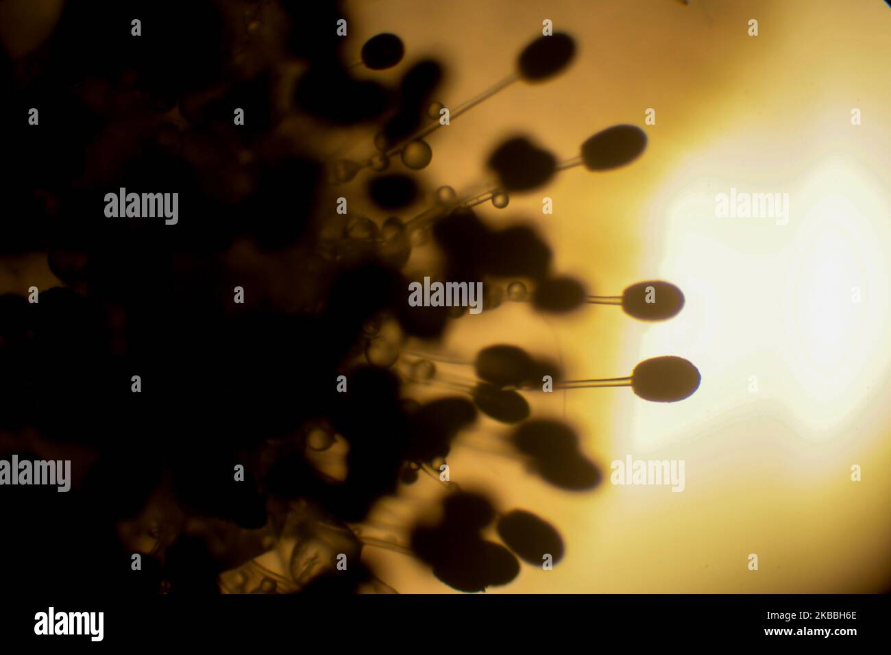 Rhizopus fungi specimen as seen through a microscope Stock Photo Alamy