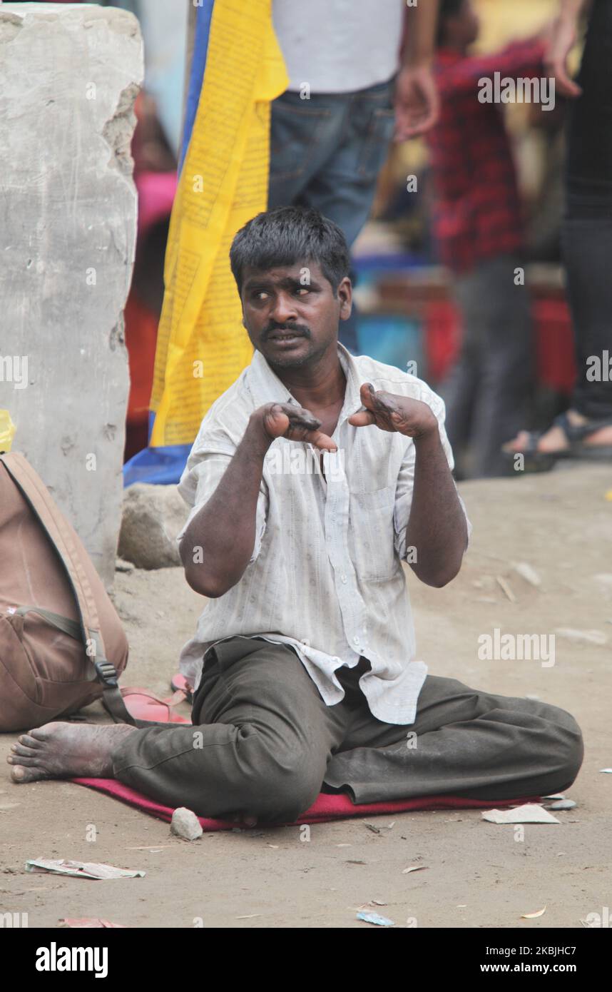 Man whose hands are deformed by leprosy begs along the roadside in ...