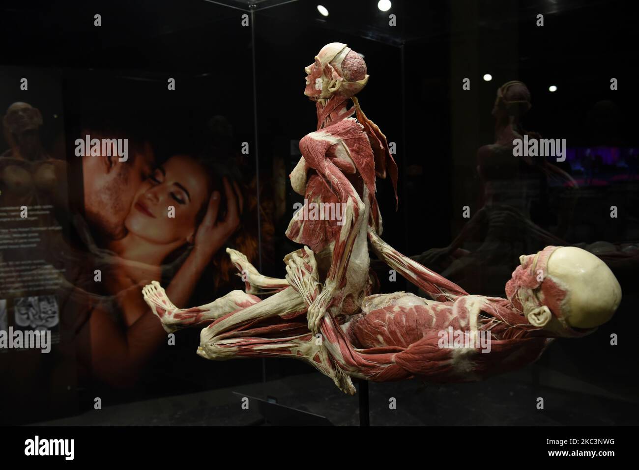 Milan, Italy. 4th Nov, 2022. Plastinator Dr. GUNTHER VON HAGENS and curator Dr AGELINA WHALLEY will present their latest exhibition BODY WORLDS - The Rhythm Of Life, in Milan, Italy.The exhibit is uniquely curated by Dr. ANGELINA WHALLEY to showcase the fragility, resilience and strength of the human body. The extraordinary real specimens demonstrate the complexity, resilience and vulnerability of the human body. The exhibition presents the body in health and distress, its vulnerabilities and potentials, and many of the challenges the human body faces as it navigates the 21st century. (Cre Stock Photo
