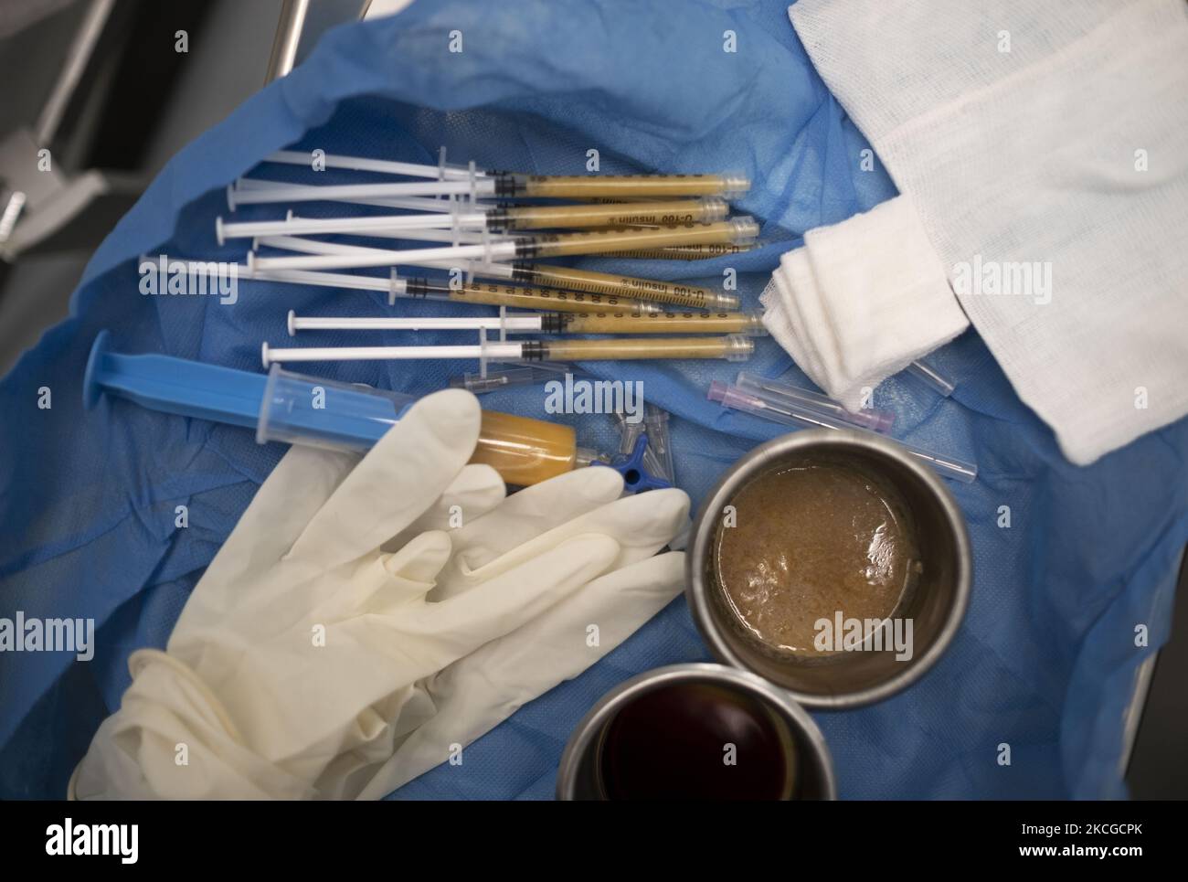 Restorative operation hi-res stock photography and images - Alamy