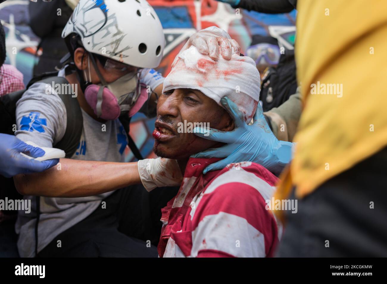 (EDITOR'S NOTE: Image depicts graphic content) A man injured during clashes with riot police is assisted by paramedics during a protest against the government in Medellin, Colombia, on June 28, 2021. Some people injured by police shoots with no letal guns. (Photo by Santiago Botero/NurPhoto) Stock Photo