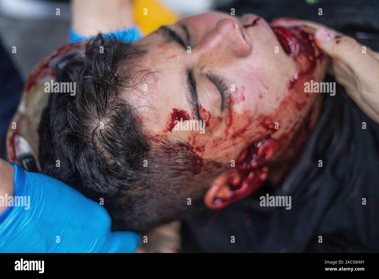 (EDITOR'S NOTE: Image depicts graphic content)A man injured during clashes with riot police is assisted by paramedics during a protest against the government in Medellin, Colombia, on June 28, 2021. Some people injured by police shoots with no letal guns. (Photo by Santiago Botero/NurPhoto) Stock Photo