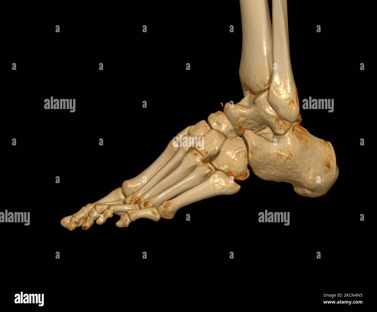 3D rendering of the foot bones for diagnosis bone fracture and