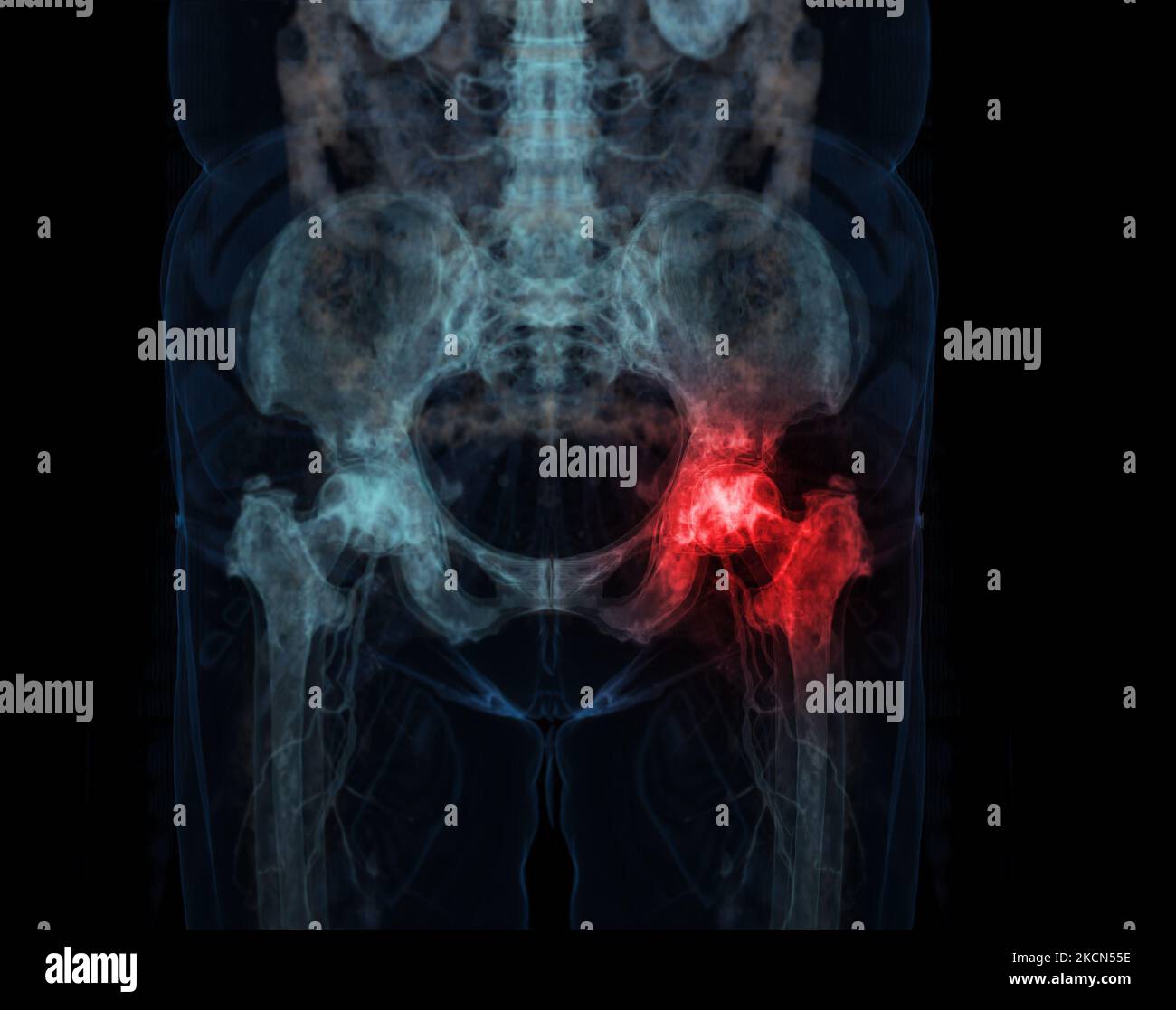 3D rendering Pelvic bone and hip joint 3D isolated on black background