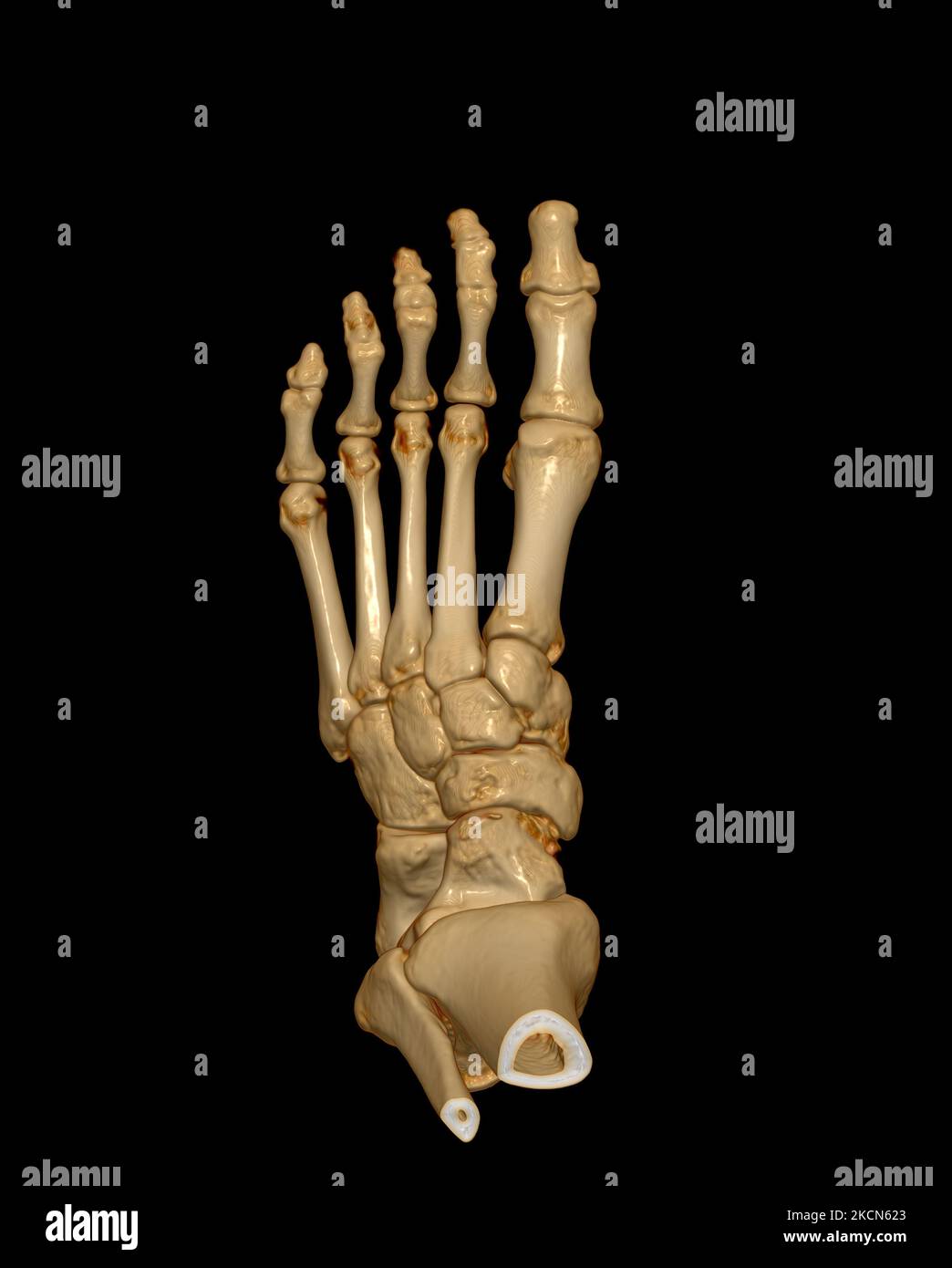 3D rendering of the foot bones for diagnosis bone fracture and