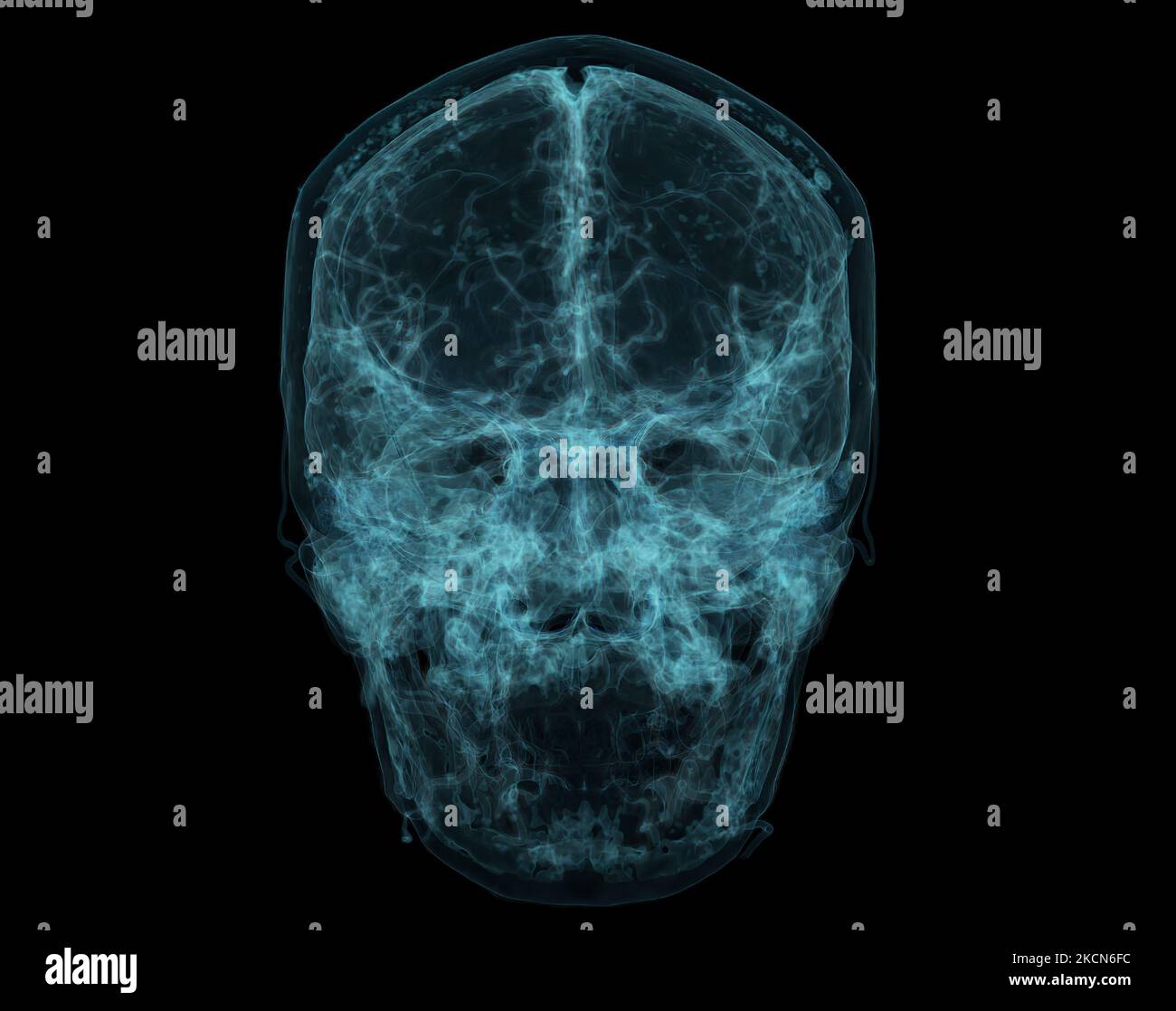 Human Skull, Brain by CT Scan. X-ray Visualization Inside Of Skull. 3D Illustration Render. Stock Photo