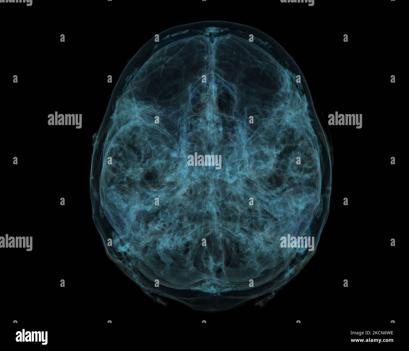 Human Skull, Brain by CT Scan. X-ray Visualization Inside Of Skull. 3D Illustration Render. Stock Photo