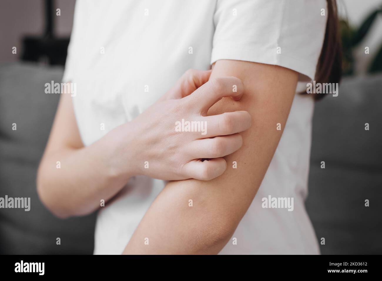 Dermatology concept. Close up of young woman suffering allergic