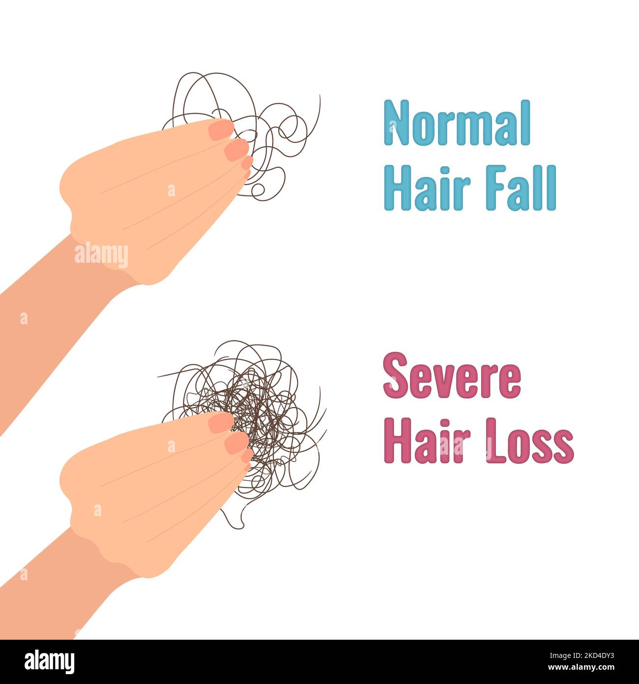 Hair shedding versus hair loss, conceptual illustration Stock Photo
