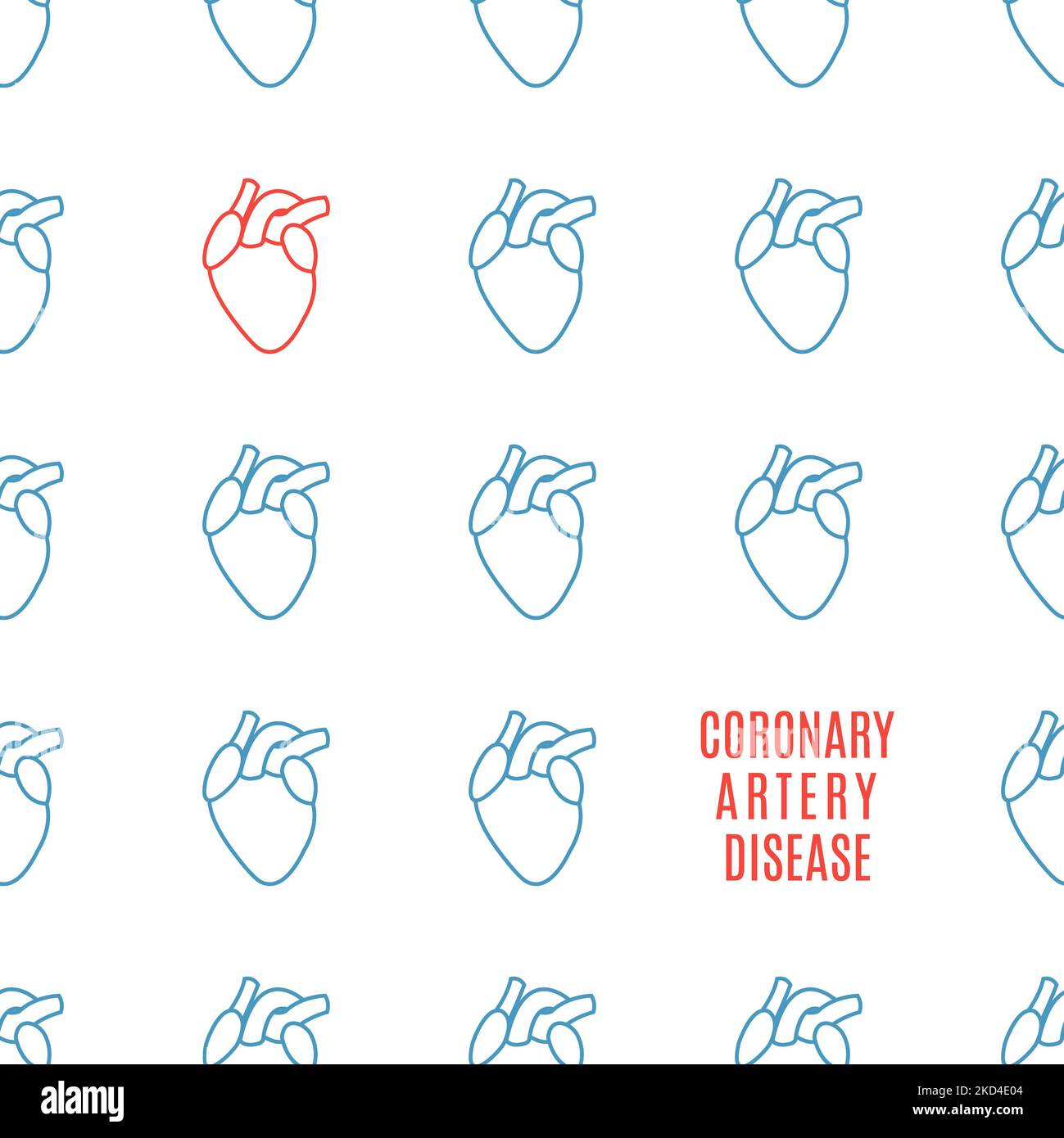 Coronary artery disease conceptual - Coronary Artery Disease Conceptual Illustration 2KD4E04 