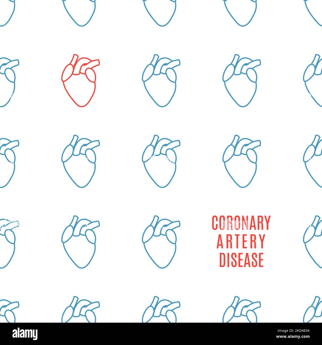 Coronary artery disease, conceptual illustration Stock Photo