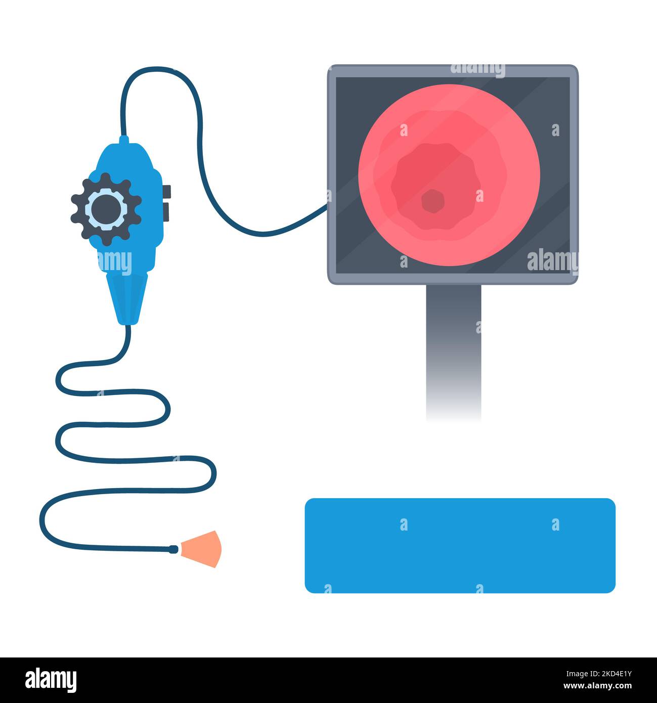 Endoscopy procedure equipment for gastrointestinal tract examination