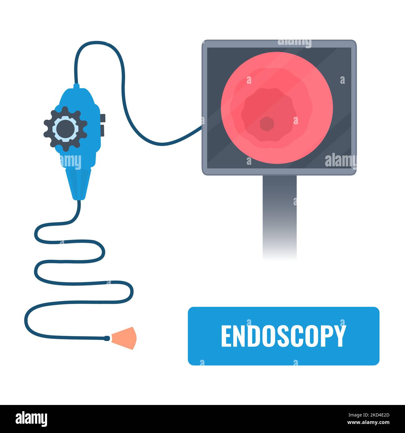 Endoscopy equipment, illustration Stock Photo