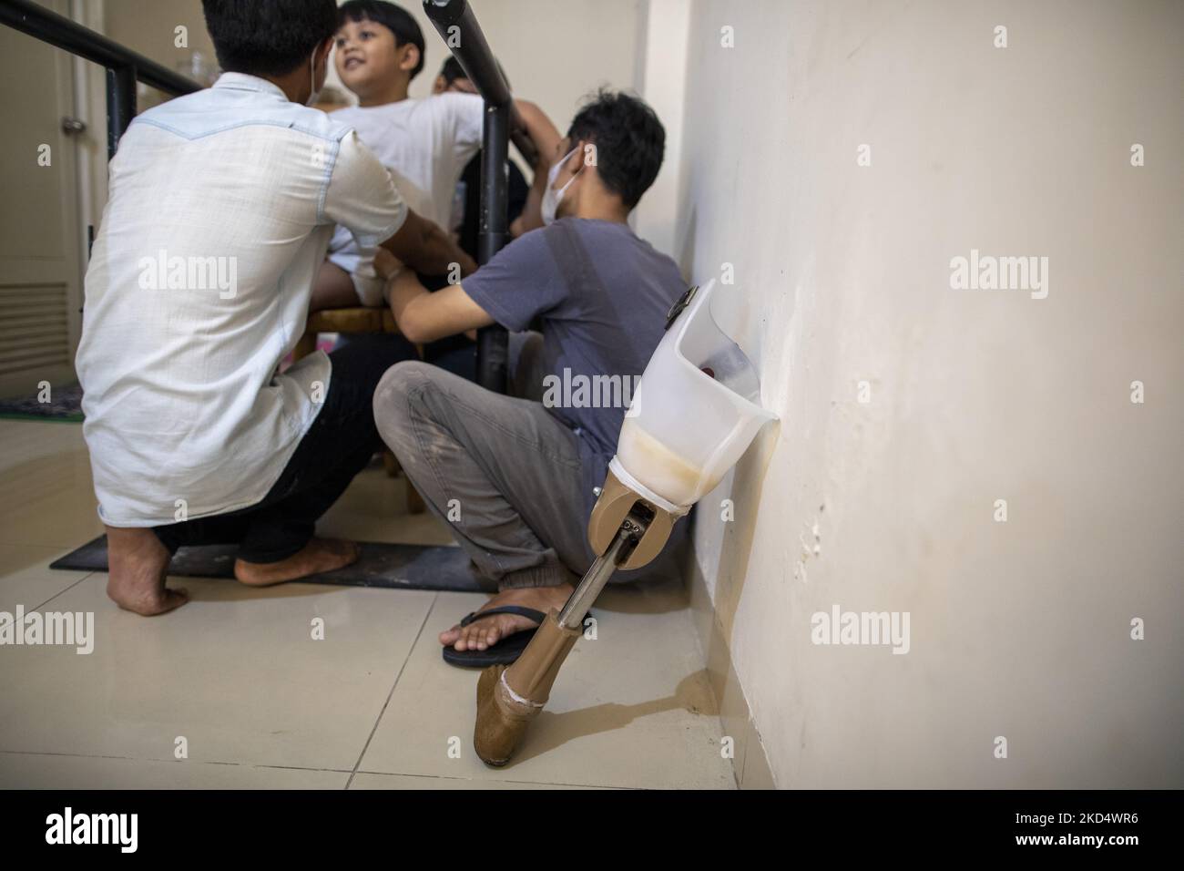 HAVY upon prepared to use the prosthetic leg. COKI TOBING, the owner of a prosthetic limb and assistive device for people with cerebral palsy named dare.id (difable care) with a passion for giving to others, makes prosthetic limbs to help his patients walk normally . In some cases he gave it away for free, and in other cases he gave it at a price far from the standard price, in Bekasi, West Java, Indonesia, on March 12, 2022. (Photo by Donal Husni/NurPhoto) Stock Photo